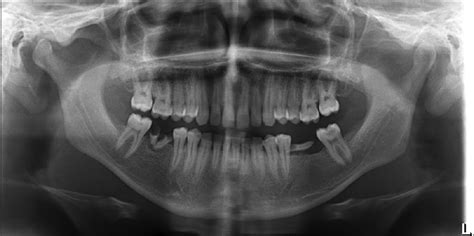 annals of maxillofacial surgery table of contents