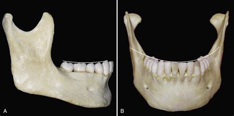 alignment  occlusion   dentition pocket dentistry