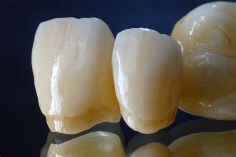 zirconia dental crown cost alternatives pros  cons