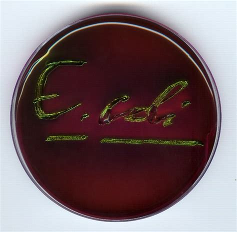 Will Culturing A Pathogenic Bacteria E G E Coli In