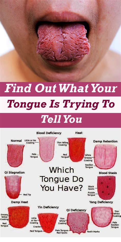 tongue telling    health healthy wellness