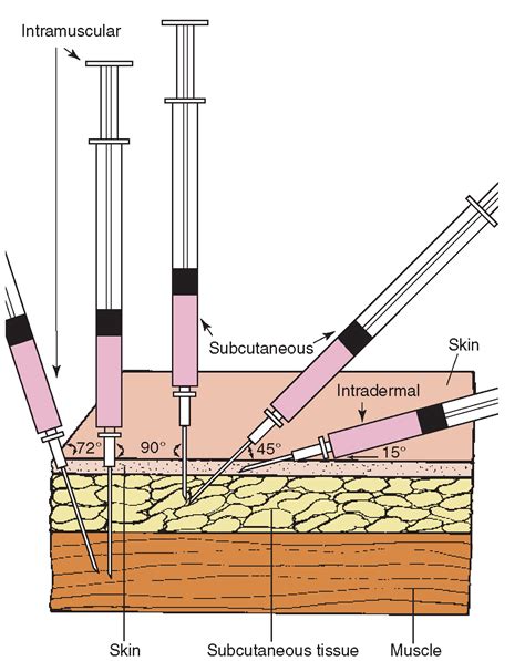Intramuscular And Subcutaneous Injections Skills Faculty
