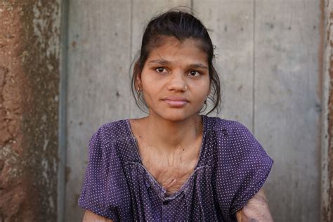 anjali 18 year old female india operation blessing
