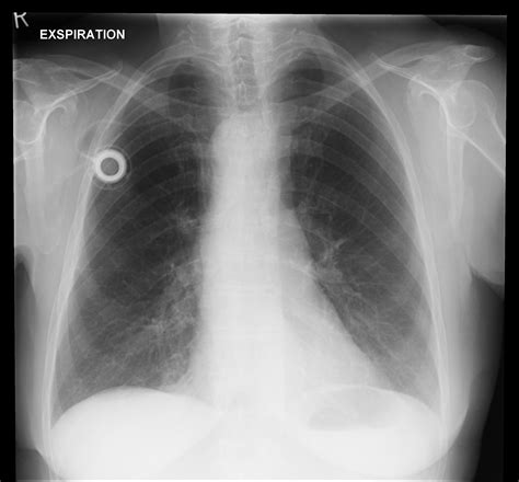 thorax radiologie herne ihre radiologen fuer offenes mrt