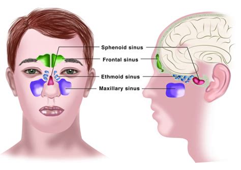 chronic sinusitis galenus health compass