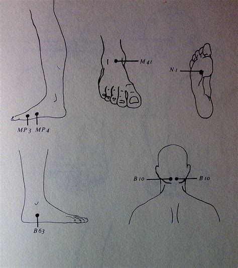 Firebert Treat Migraine Headache With Massage And Pressure Points Only