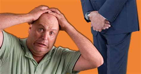 men fear hair loss more than erectile dysfunction and sex diseases