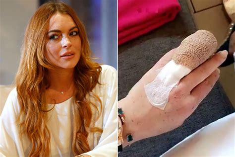 Lindsay Lohan Says She Lost Part Of Finger In Boat Accident Page Six
