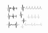 Heartbeat Rhythm Vecteezy Modificare Edit Vectorified Ritmo Cardiaco Linea Raccolta Vettore sketch template