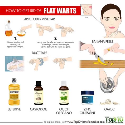 how to get rid of flat warts top 10 home remedies