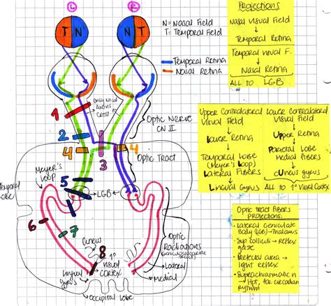 notes  usmle visual pathway visual field lesions