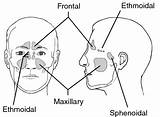 Sinus Paranasal Sinuses Sphenoidal Dorland 2000 sketch template