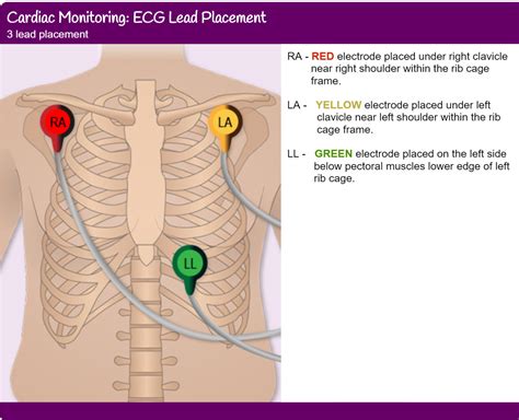 lead ecg placement yqf medical cable