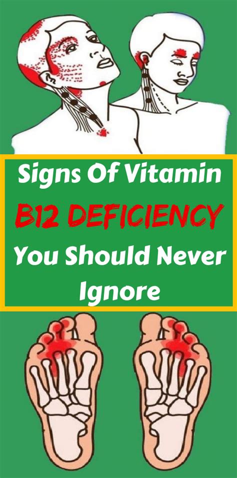 signs of vitamin b12 deficiency you should never ignore