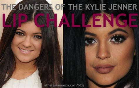 Kylie Jenner Lip Challenge Fails Compilation Famous Person