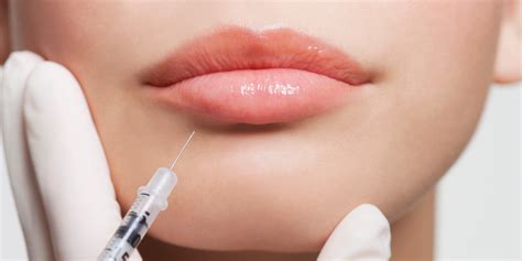facial fillers  injections   biggest trends  plastic surgery