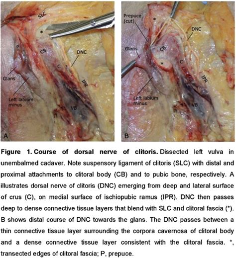 16 Anatomy Of Clitoris And Associated Neurovascular Structures
