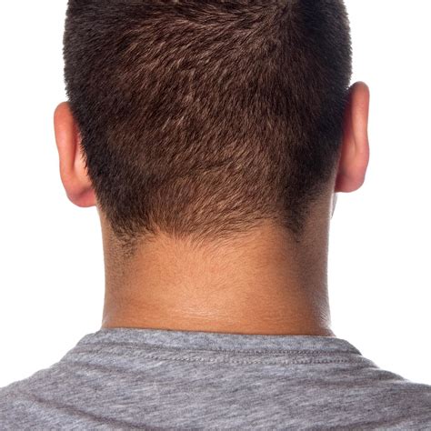 head  neck melanomas  young adults rose    decade kjzz