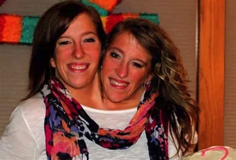 18 Things Most People Don T Know About Conjoined Twins