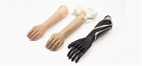 types  upper extremity prosthetic hands