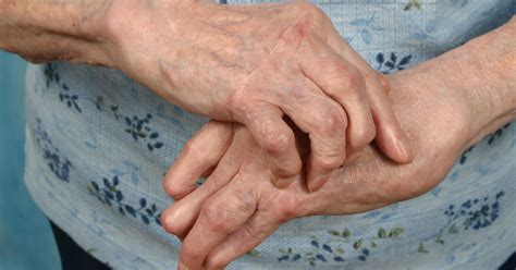 manage rheumatoid arthritis symptoms  wellness techniques