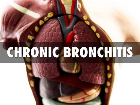 bronchitis 10 bronchitis symptoms