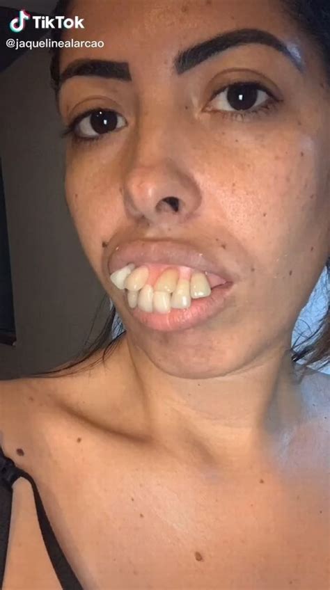 womans teeth transformation  millions  views   spot
