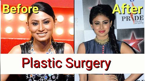 top 10 plastic surgery photos of popular tv actresses before and after youtube