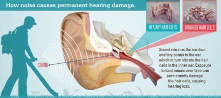 noise induced hearing loss hearing loss association  america