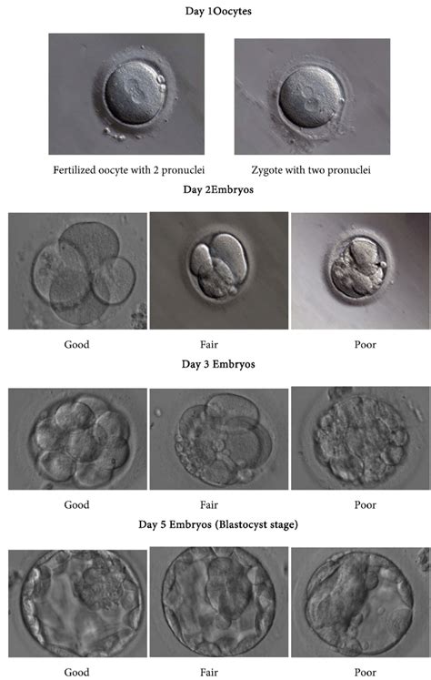 morphology  quality  embryos  days
