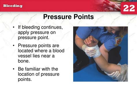 Ppt 22 Bleeding Powerpoint Presentation Free Download Id 4562476