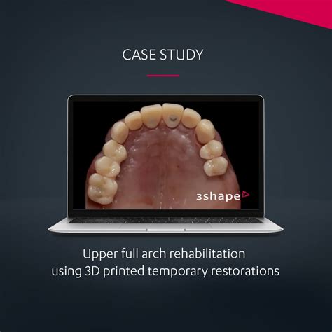 upper full arch rehabilitation case study