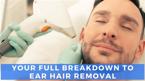 laser ear hair removal      laserall