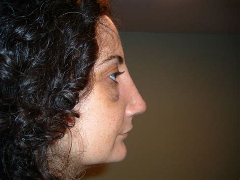 greek nose page
