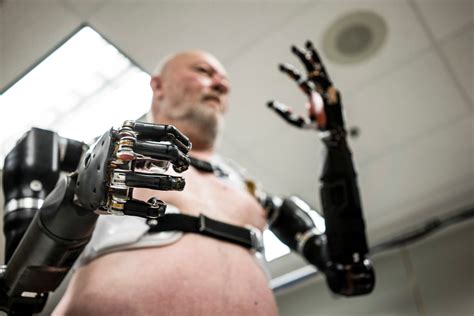 atom limbs artificial limbs   human body