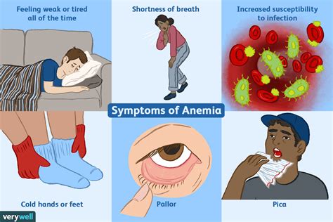 symptoms  iron deficiency anemia  diet plan  fight