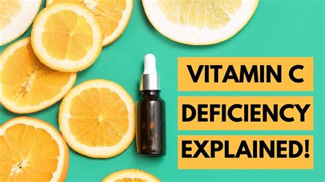How Vitamin C Deficiency Effect Oral Cavity Oral Manifestations Of