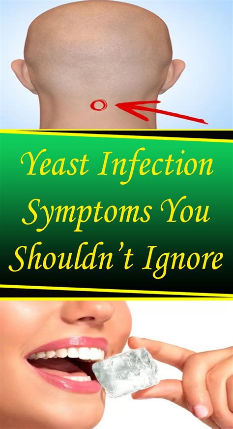 yeast infection symptoms  shouldnt ignore viral nancieblogspotcom