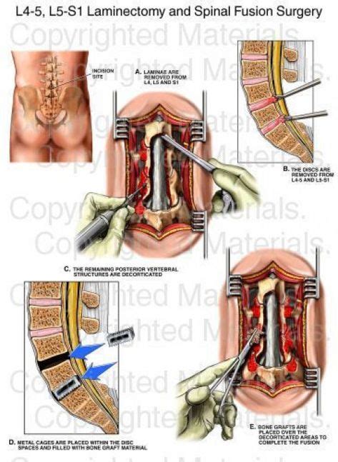 44 ideas de esqueleto humano fisiología anatomia y fisiologia humana