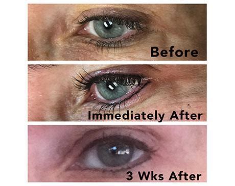 microblading albuquerque nm flawless med spa
