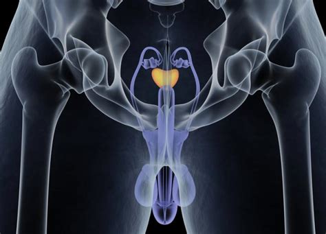 how does prostate cancer affect sex medical news today