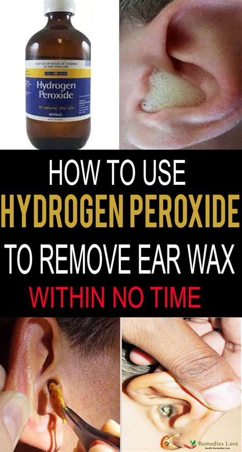 how to use hydrogen peroxide to remove ear wax remedies lore