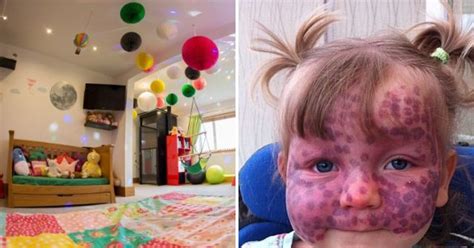 bedroom makeover for matilda callaghan with polka dot skin condition