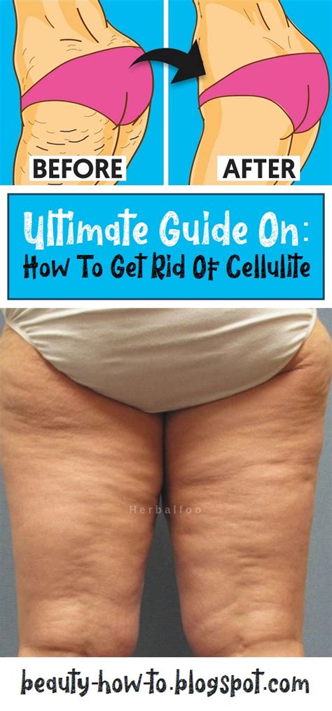 ultimate guide     rid  cellulite   beauty