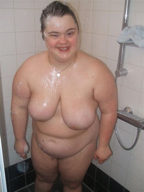 down syndrome girls nude