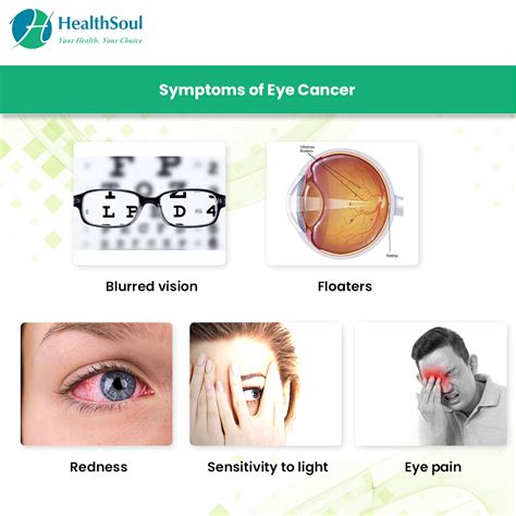 eye cancer symptoms  treatment healthsoul