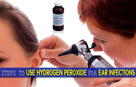 ears   clean  hydrogen peroxide cleaning tips