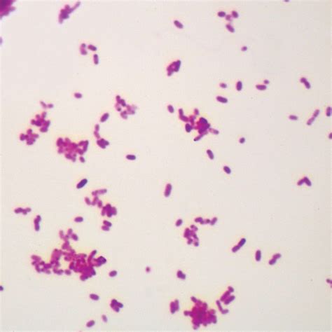 salmonella typhimurium wm microscope  carolinacom