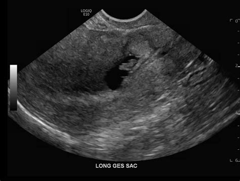 casestackscom ultrasound
