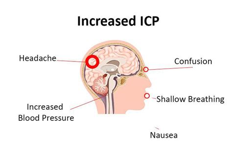 increased icp medizzy